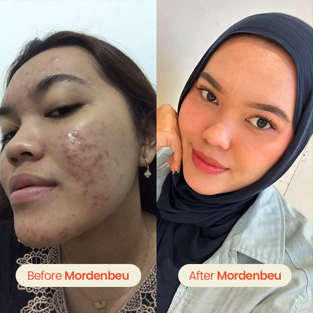 testi 2