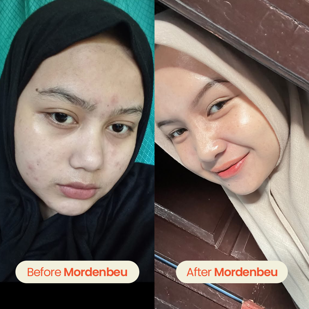 testi 3