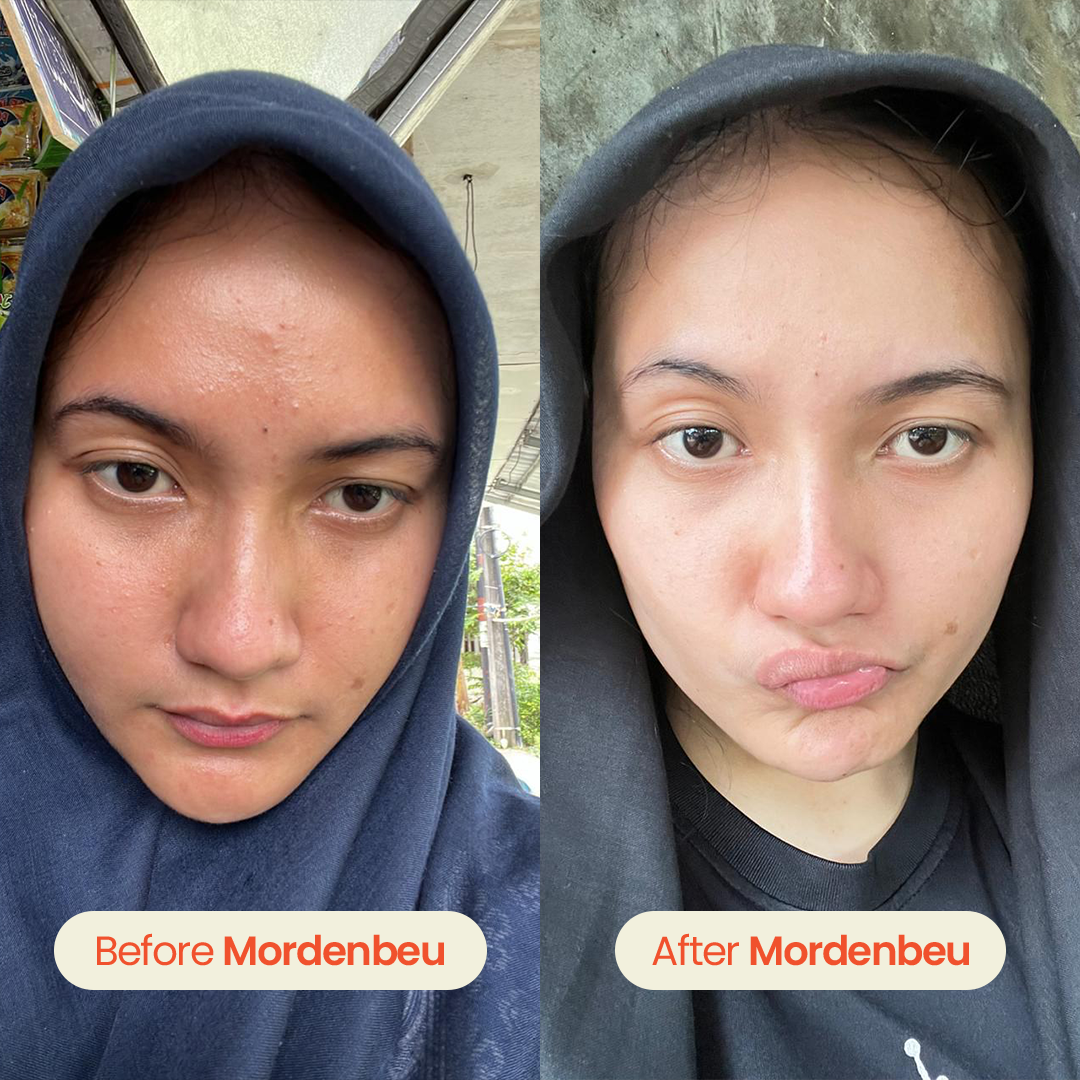 testi 5